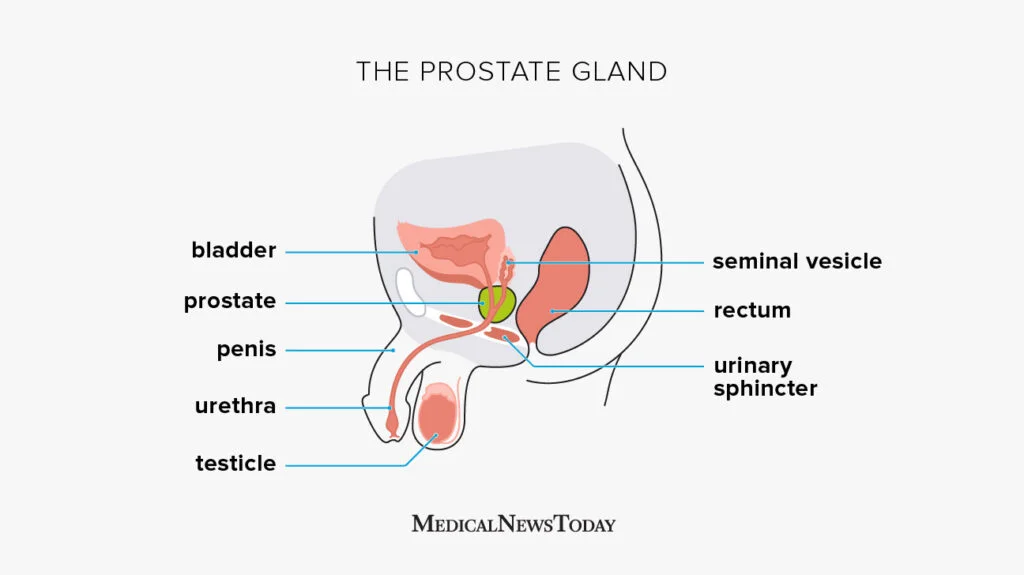 prostate cancer
