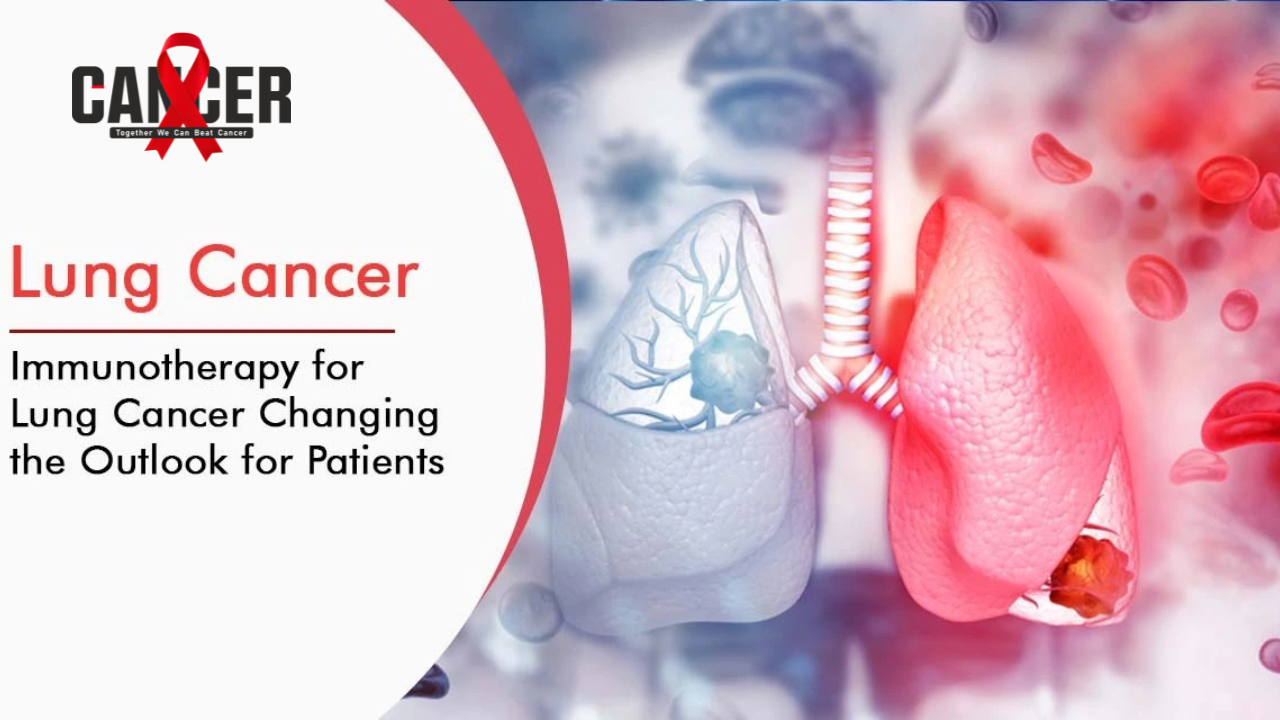 Lung Cancer & Immunotherapy: Changing the Outlook for Patients