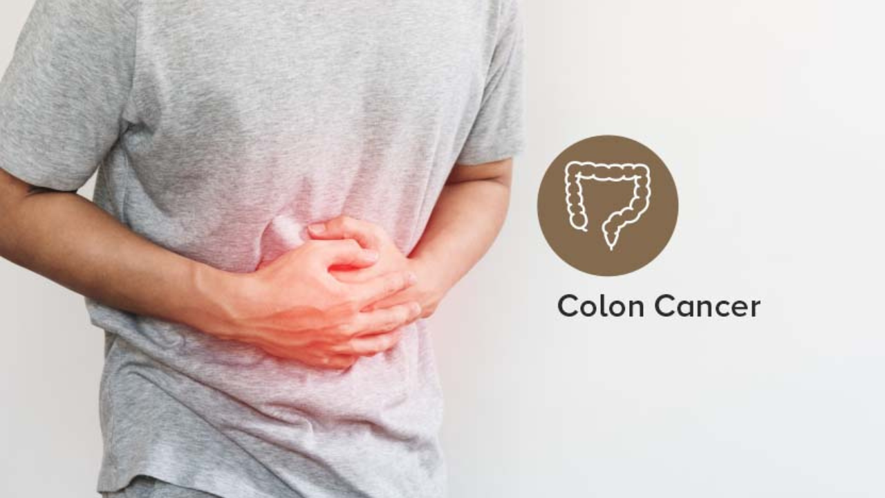 Understanding Colon Cancer: Symptoms, Causes, and Diagnosis