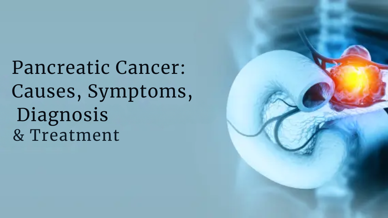 Pancreatic Cancer: Symptoms, Causes, Diagnosis, Treatment & More