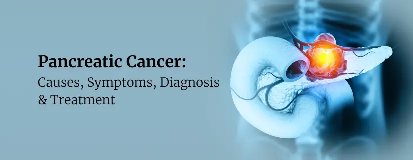 Pancreatic Cancer